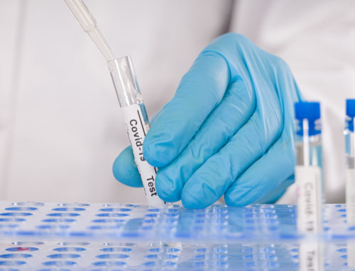 PRUEBAS PCR